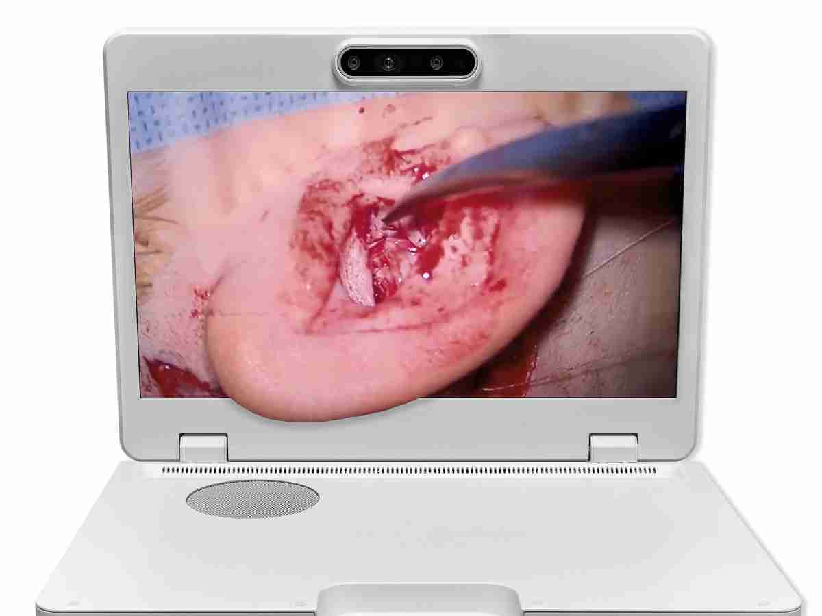 达擎之＂Heads-up 3D显微手术显示系统＂，，，，整合4K裸眼3D显示及眼球追踪系统，，，具备快速追踪人眼移动位置功能，，，减轻医师长时间维持固定姿势的负担，，让医师能有更宽广清晰的3D立体视野及更舒适的姿势来执行手术。。。。